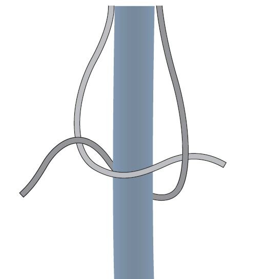 Kreuzknoten